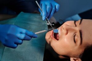 dental implants